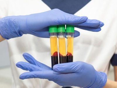 Close,Up,Medic,Woman,Hand,In,Blue,Medical,Gloves,Holds